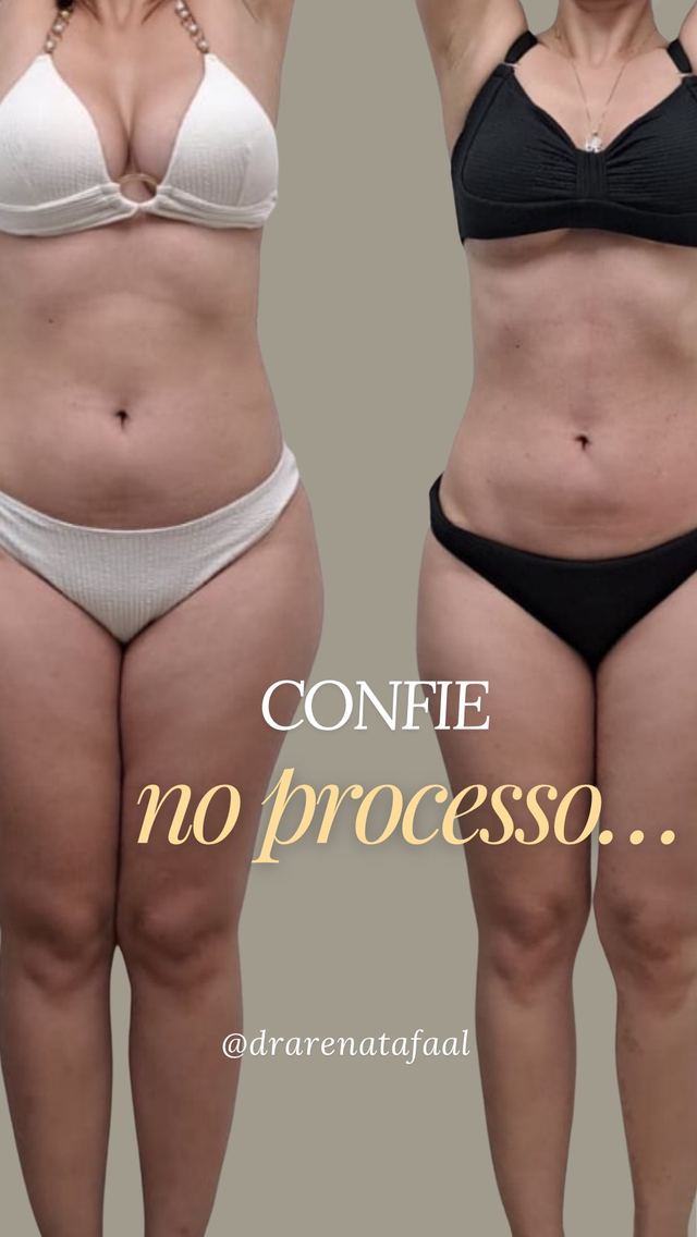 Post do Instagram @drarenatafaal: Confie no processo — 1 ano de transformação
